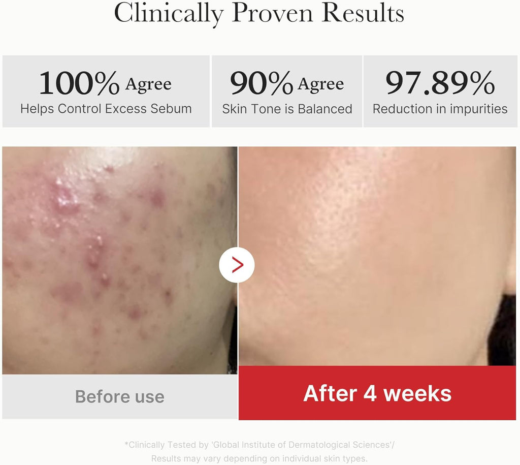 Medicube Red Succinic Peeling Pads