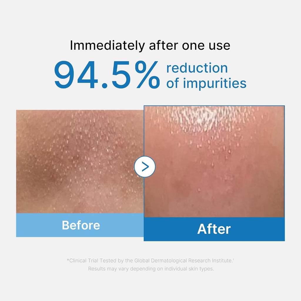ANUA x Medicube Deep Pore Double Cleansing Bundle