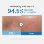 ANUA x Medicube Deep Pore Double Cleansing Bundle