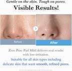 Medicube Zero Pore Pad Mild
