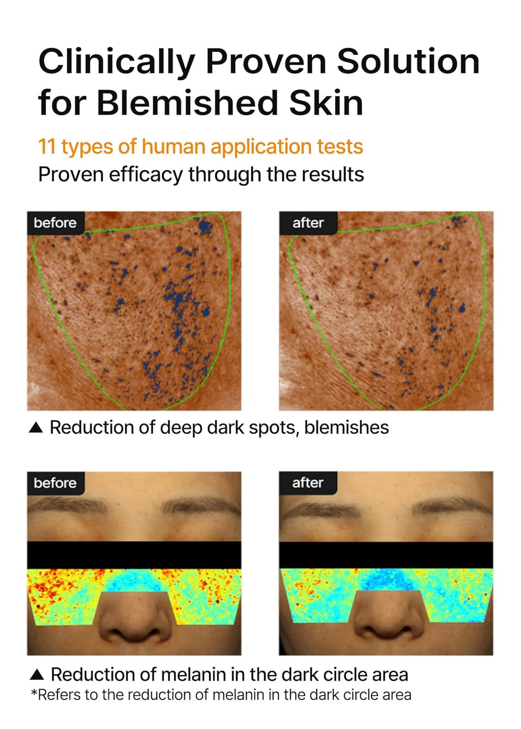CELIMAX Pore + Dark Spot Brightening Cream
