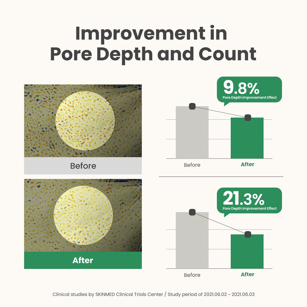 AXIS-Y Mugwort Pore Clarifying Wash Off Pack 100g