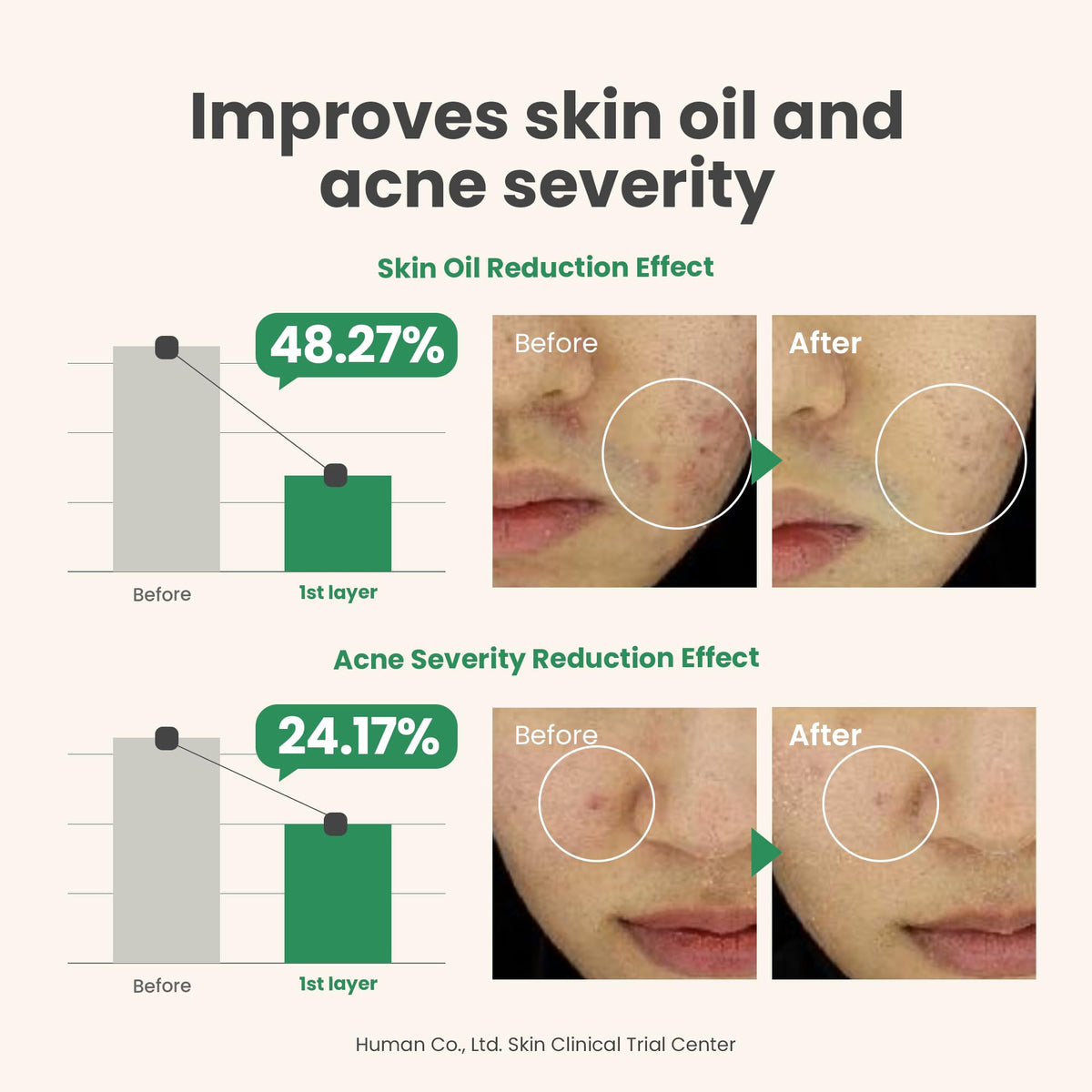 AXIS-Y Spot The Difference Blemish Spot Treatment 15ml