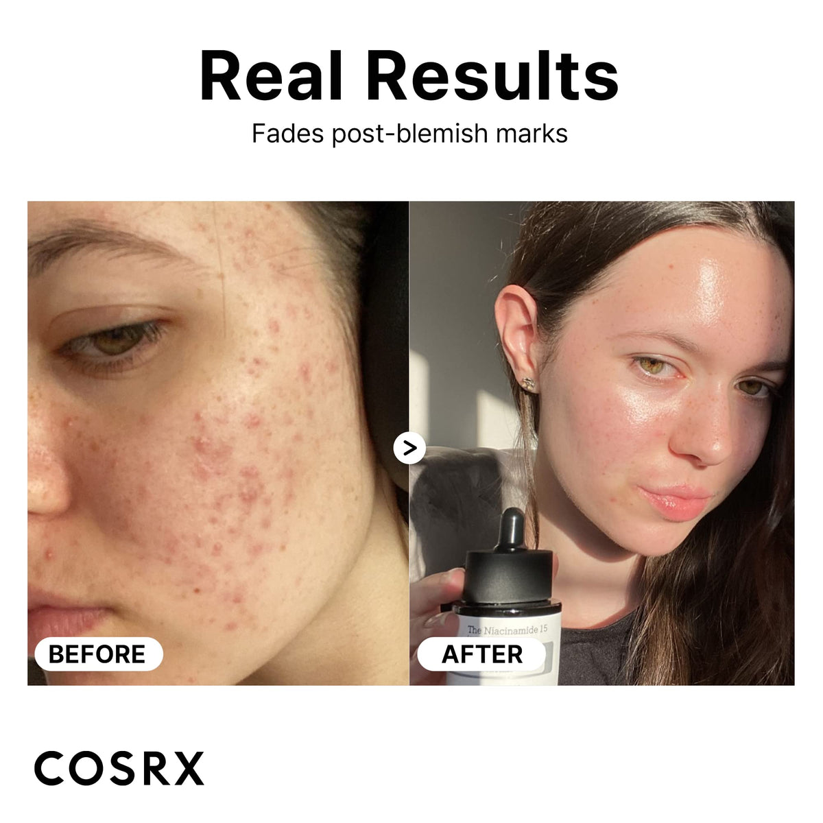 COSRX 15% Niacinamide Face Serum 20ml