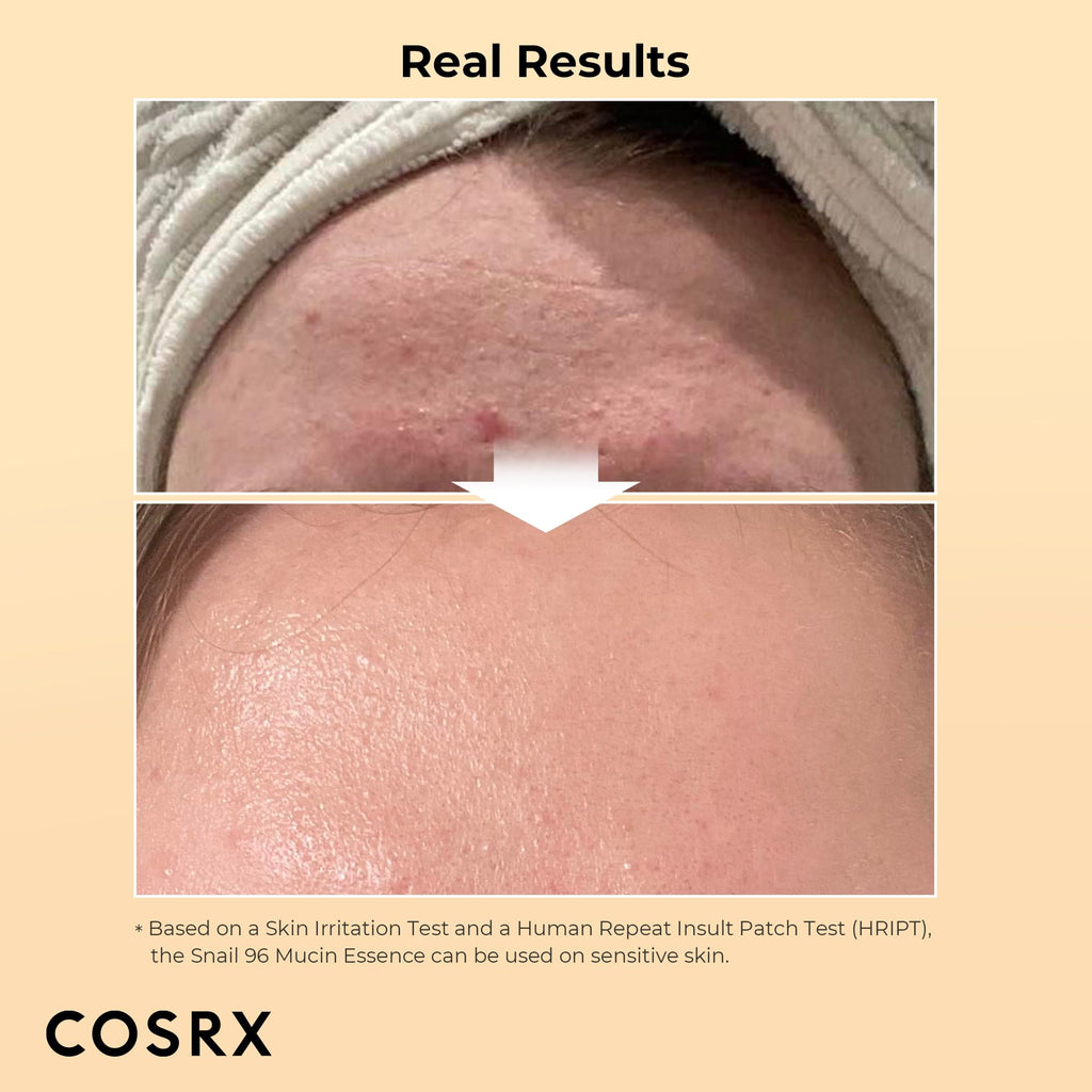 COSRX Snail Mucin 96% Power Repairing Essence 100ml
