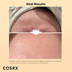 COSRX Snail Mucin 96% Power Repairing Essence 100ml