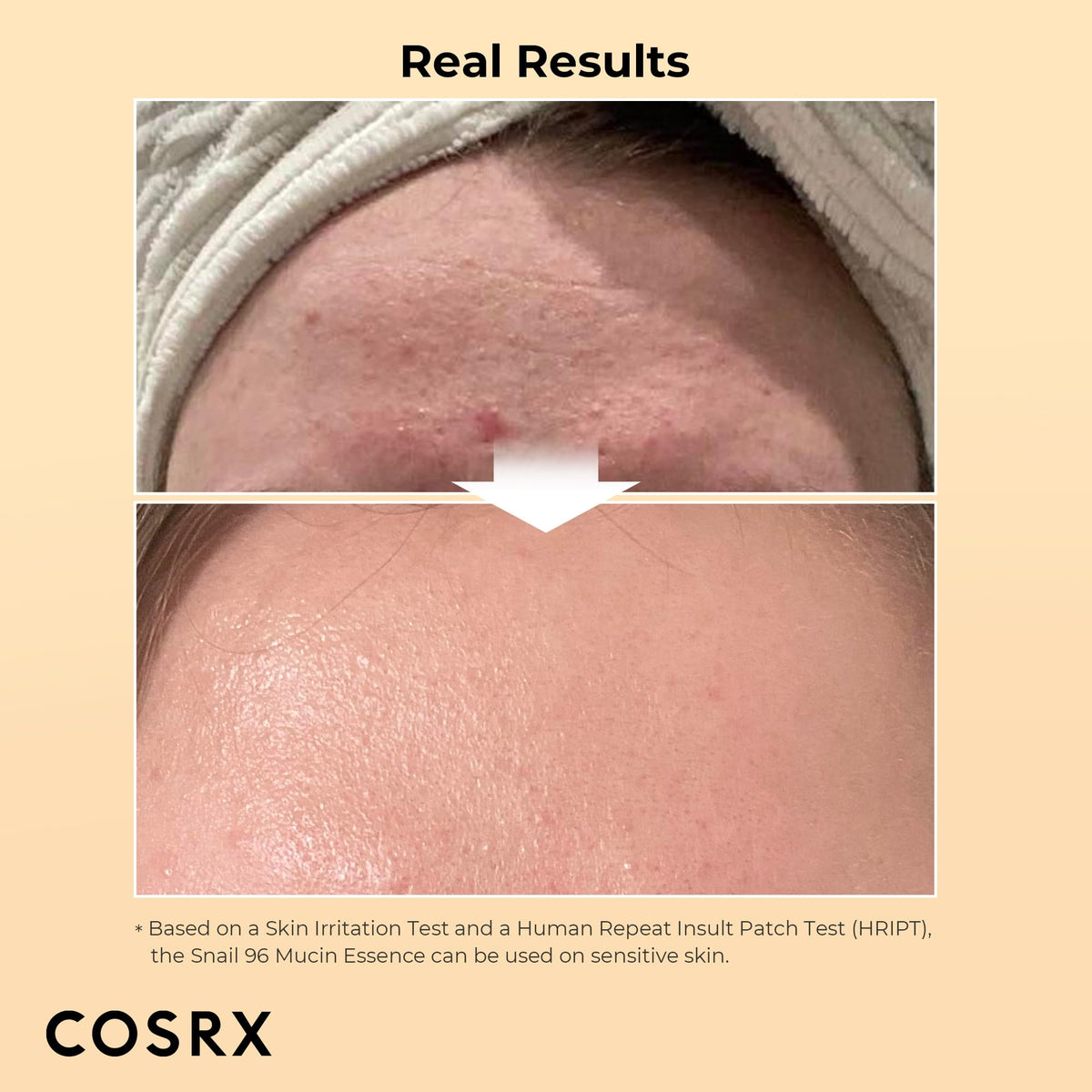 COSRX Snail Mucin 96% Power Repairing Essence 100ml