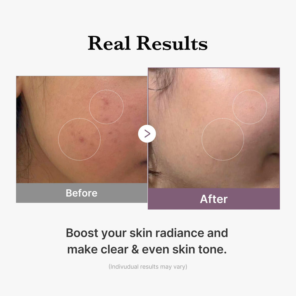 Medicube Age-R Glutathione Glow Milky Toner 140ml