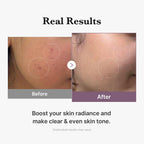 Medicube Age-R Glutathione Glow Milky Toner 140ml
