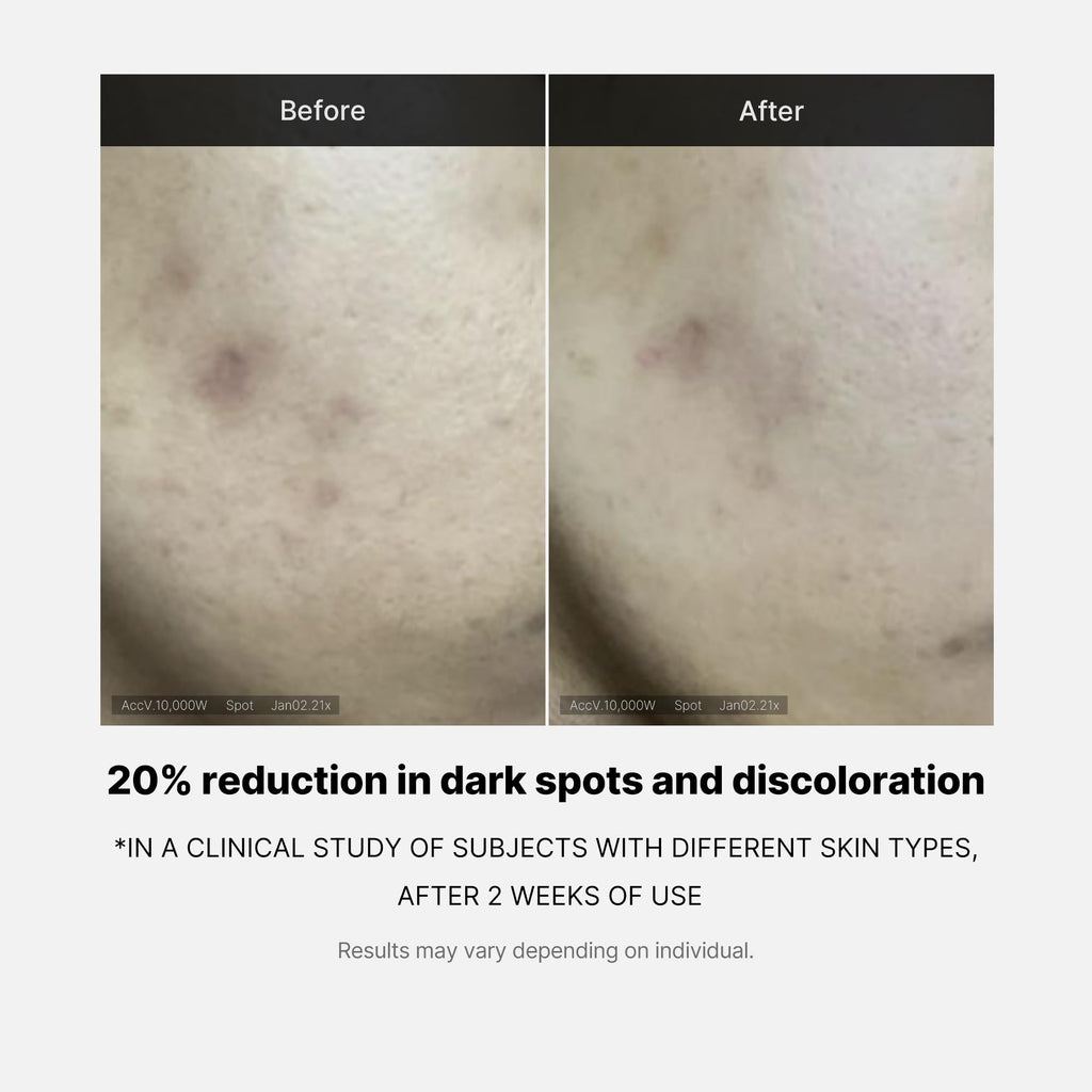 Medicube Deep Vita C Serum 2.0 14.5% Pure Vitamin C 10g