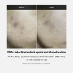 Medicube Deep Vita C Serum 2.0 14.5% Pure Vitamin C 10g