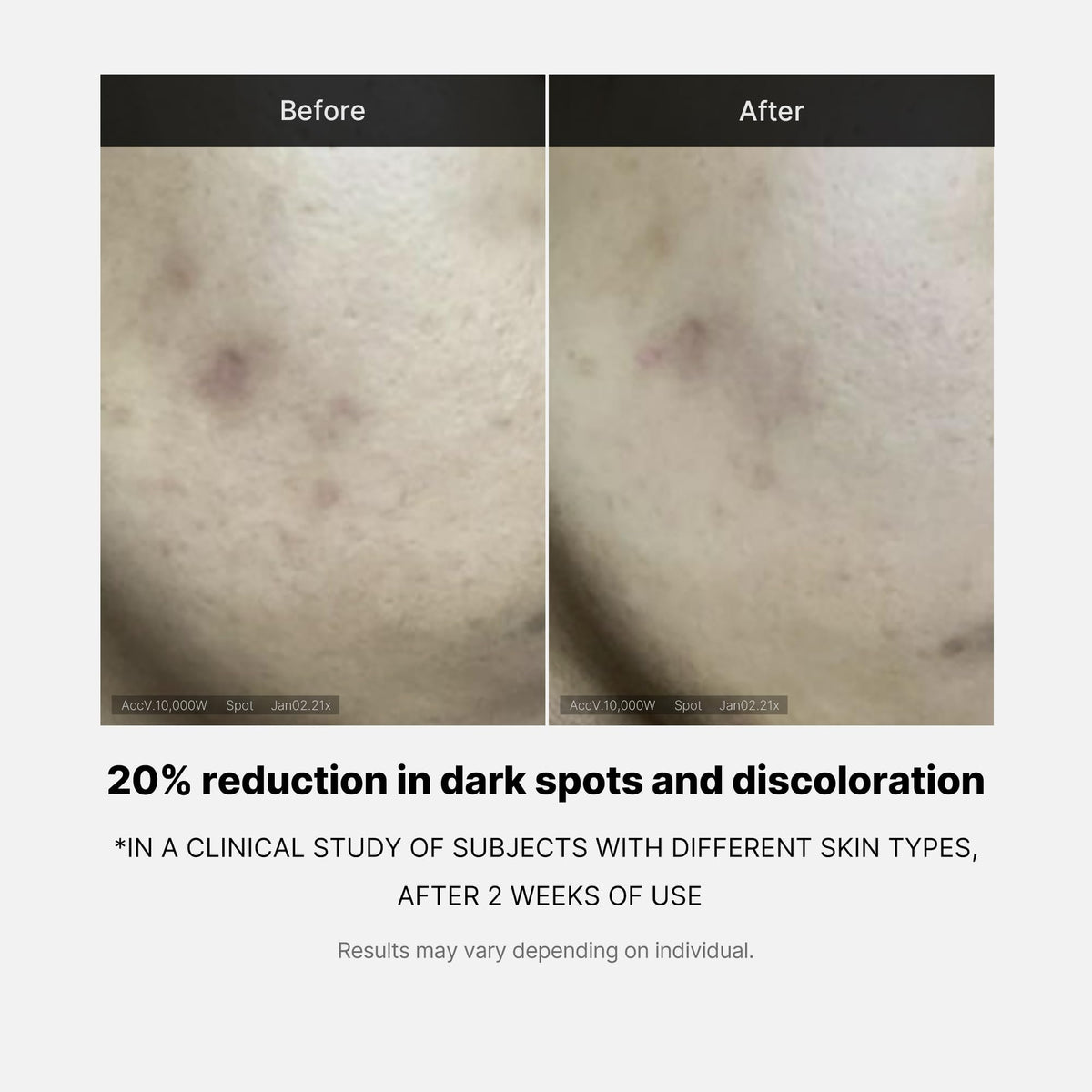 Medicube Deep Vita C Serum 2.0 14.5% Pure Vitamin C 10g