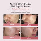 Medicube Salmon DNA PDRN Pink Peptide Serum