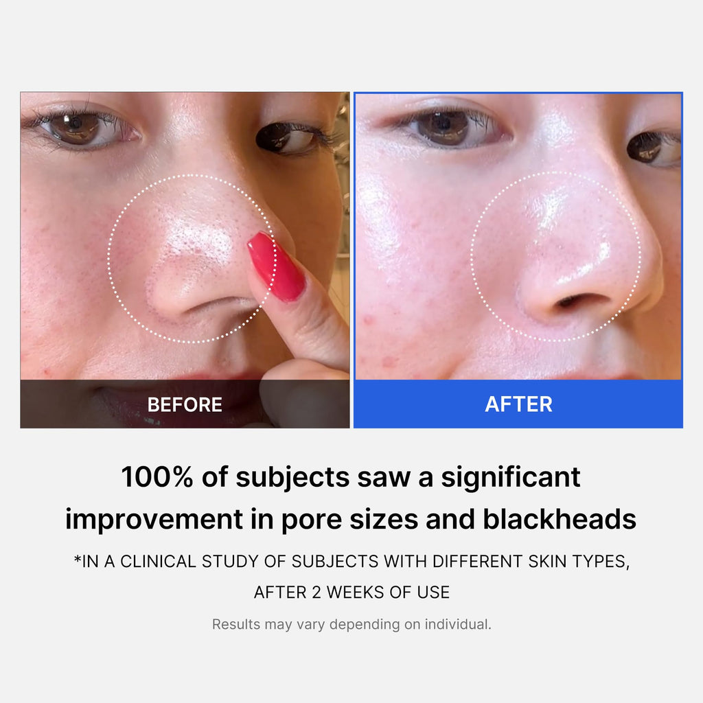 Medicube Zero Pore Pad 2.0