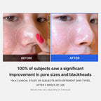 Medicube Zero Pore Pad 2.0