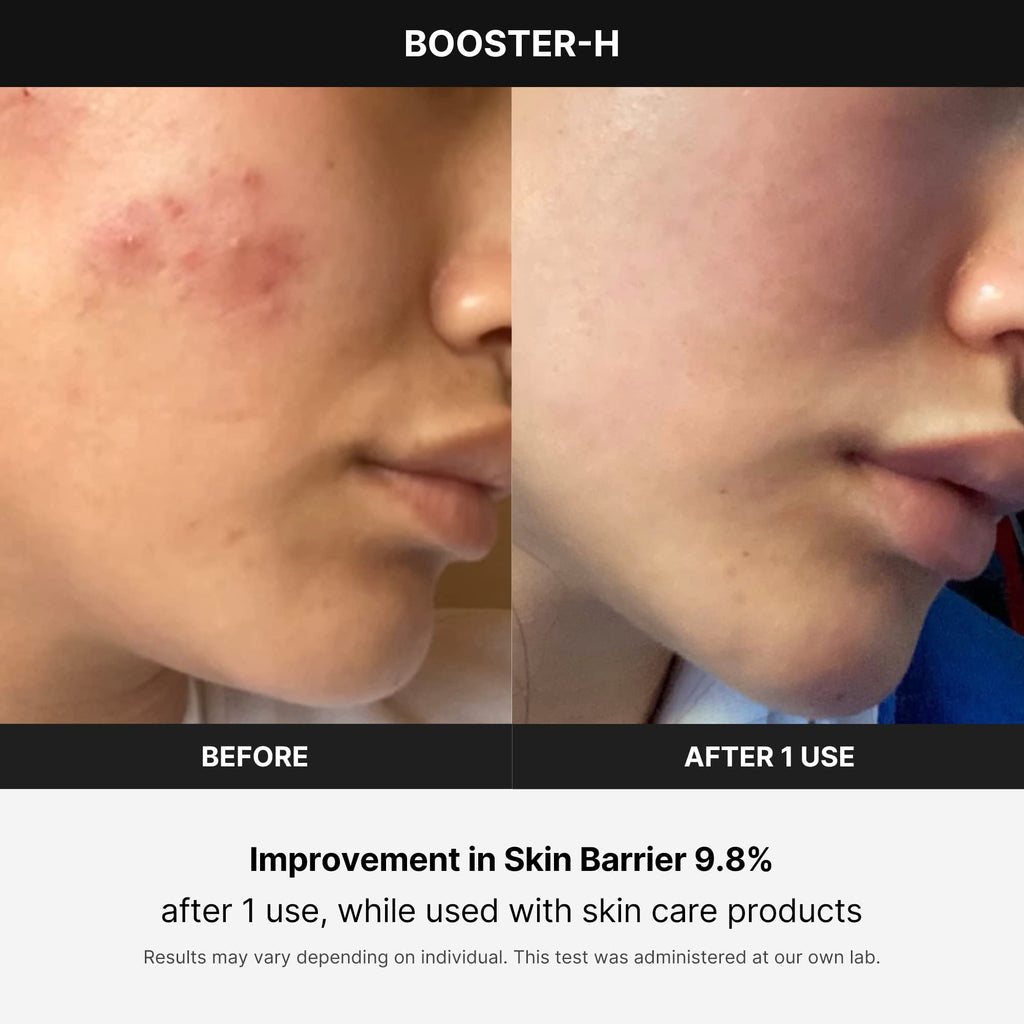 Medicube Booster H - Korean Skincare Tool