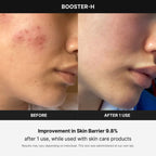 Medicube Booster H - Korean Skincare Tool