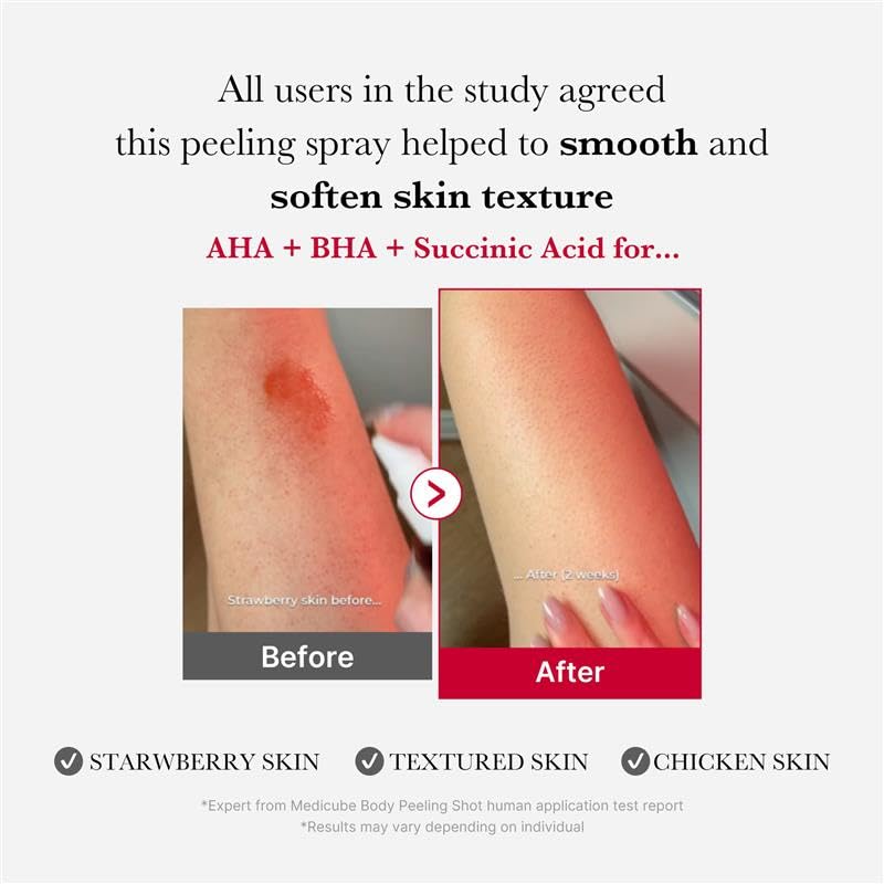 Medicube Red Body Peeling Shot, Body Spray 110g