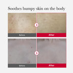 Medicube Red Body Peeling Shot, Body Spray 110g