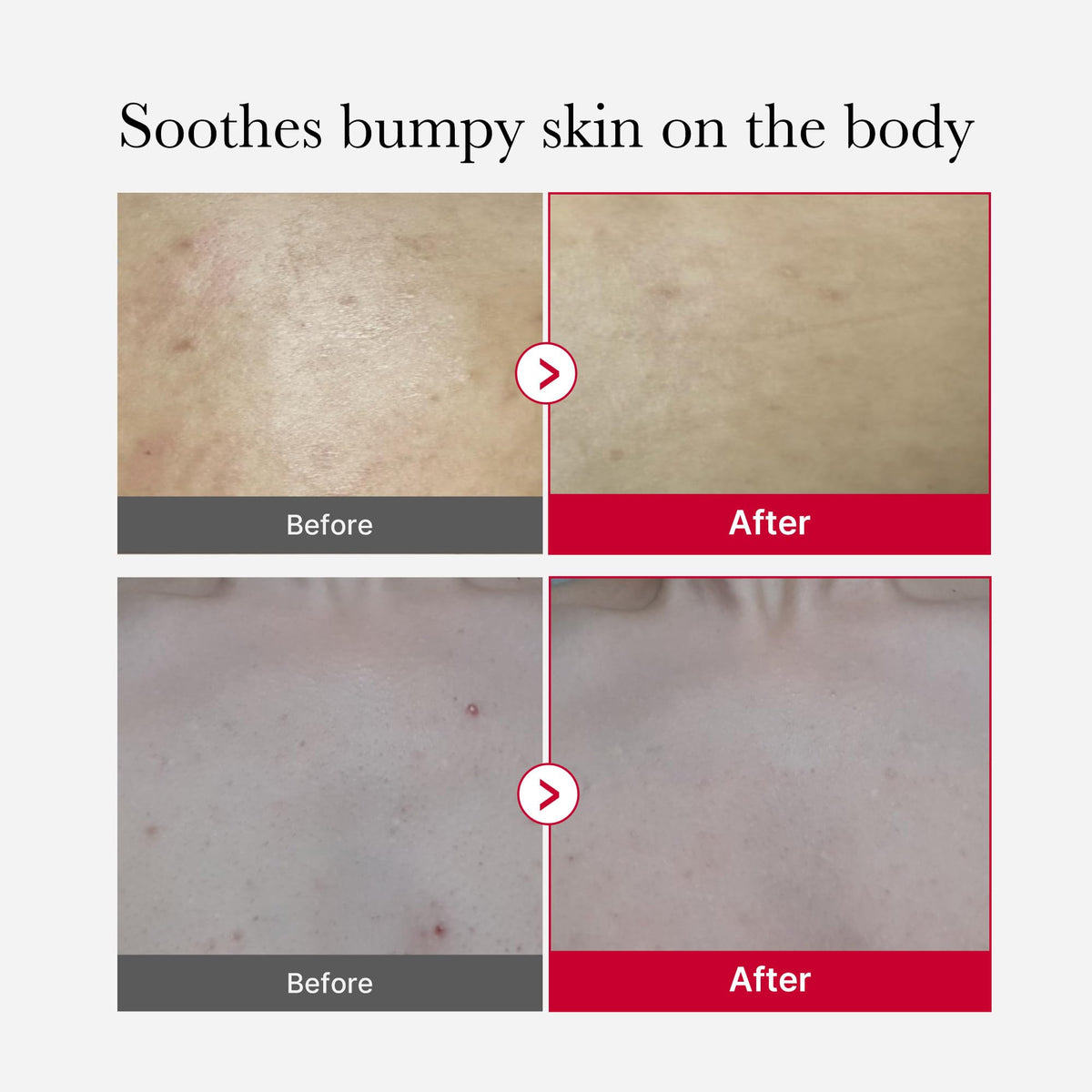 Medicube Red Body Peeling Shot, Body Spray 110g