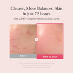 Medicube TXA+Niacinamide 15% Glow Facial Serum 30ml