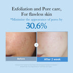 Medicube Zero Pore Toner Exfoliating & Hydrating Blue Bottle Water Toner 250ml